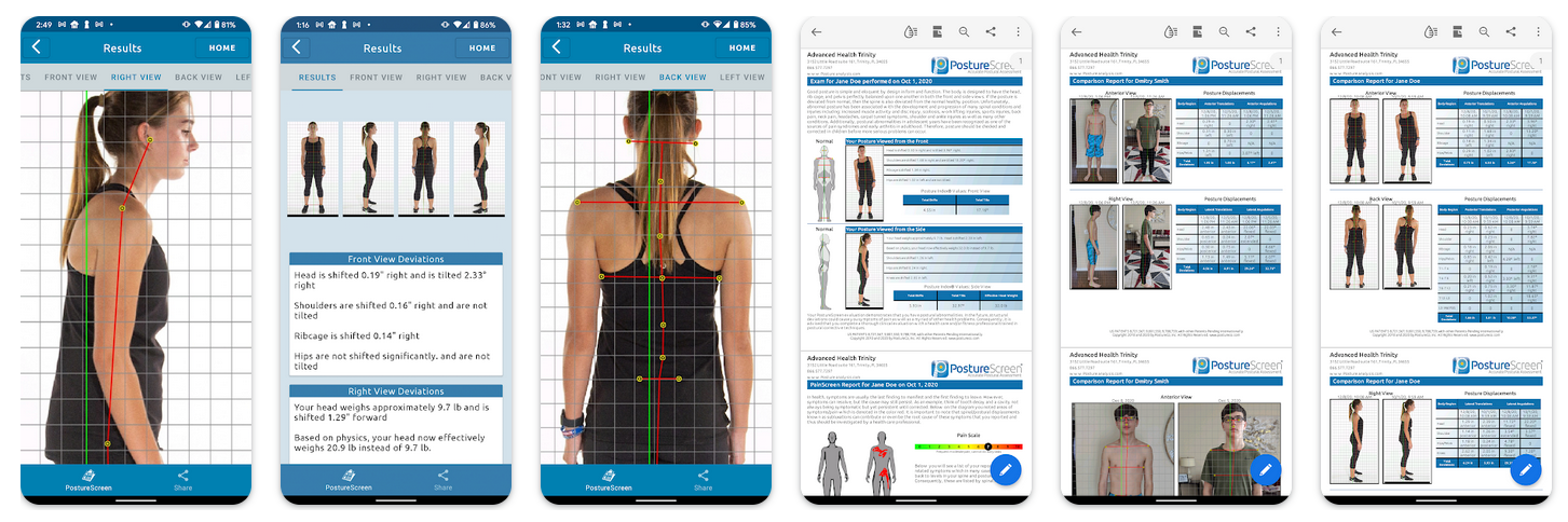 1691312493 534 Aplicaciones para mejorar la salud postural - Aplicaciones para mejorar la salud postural